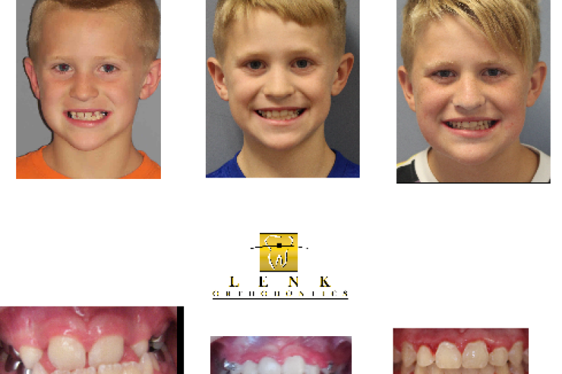 Lenk Ortho doesn't just worry about straight teeth on a model