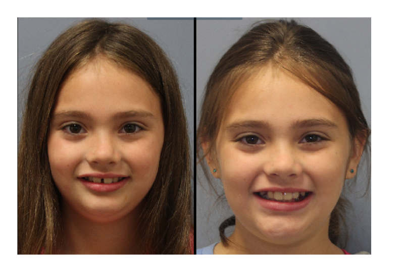 Lenk Orthodontics produces beautiful smiles.