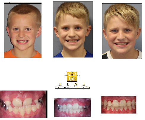 Lenk Ortho doesn't just worry about straight teeth on a model