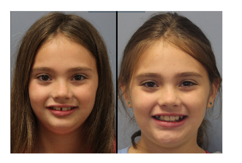 Lenk Orthodontics produces beautiful smiles.